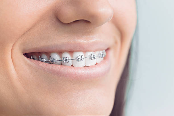 TMJ/TMD Treatment in Sands Point, NY